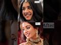 Secret Behind Her Beautiful Smile Shorts Viral Radhikamerchant 