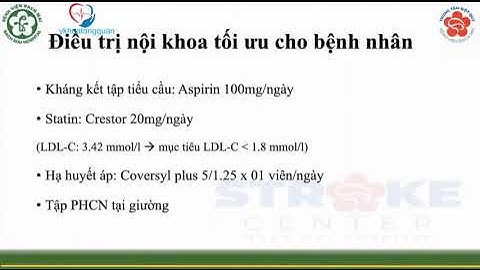 Case nhồi máu do hẹp động mạch cảnh ngoài sọ