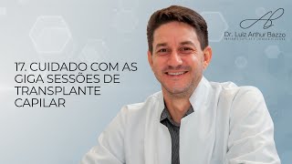 CUIDADO com as giga sessões de transplante capilar | Dr. Luiz Arthur Bazzo