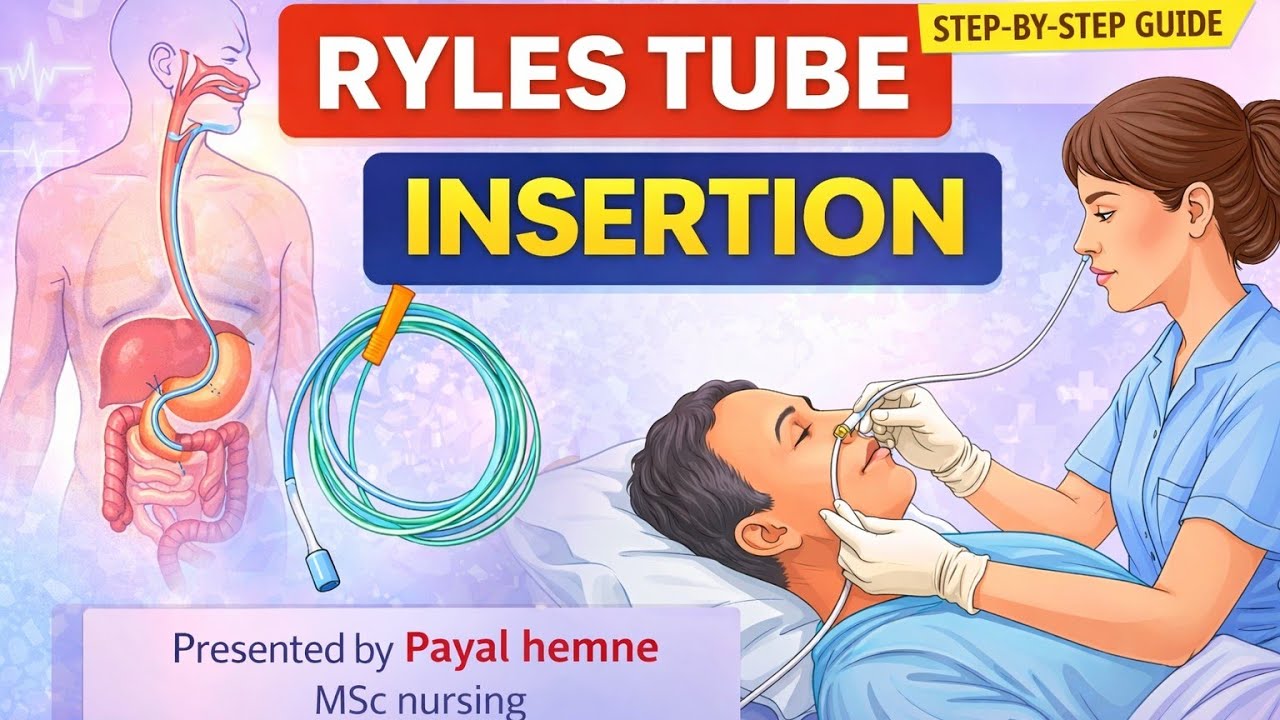 Ryles Tube Example Ryles Tube Insertion Procedure Step by Step | NG Tube |#viral # ...