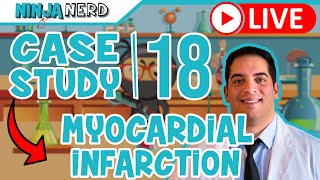 Case Study #18: Myocardial Infarction
