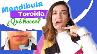 ¿Sabes qué paso aquí? MANDIBULA TORCIDA