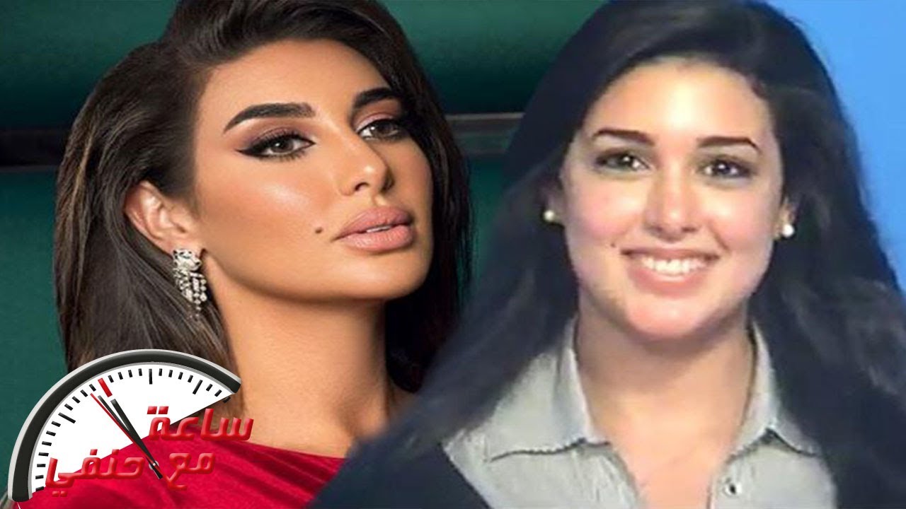 زوج يطلب من طبيب تجميل عجن وجه زوجته مثل الفنانه ياسمين صبرى