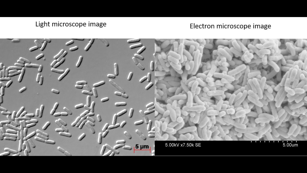 Bacteria under a light vs electron microscope? SciTales