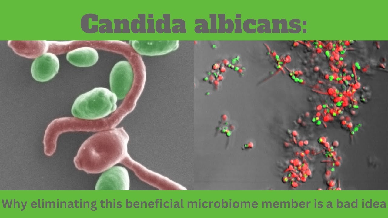 Candida albicans: Why eliminating this beneficial microbiome member is a bad idea