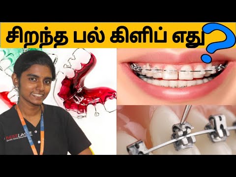 பல் கிளிப் சிகிச்சை செலவு(Types and cost of teeth braces in tamil)