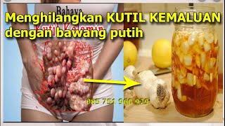 Download Cara Menghilangkan Kutil Kemaluan Dengan Bawang Putih Video MP3 Cara Menghilangkan Kutil Kemaluan Dengan Bawang Putih