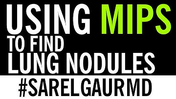 Using MIPS to find Lung Nodules on CT