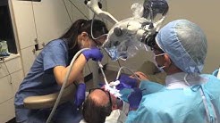 Example Treatment #1 - General Anesthesia