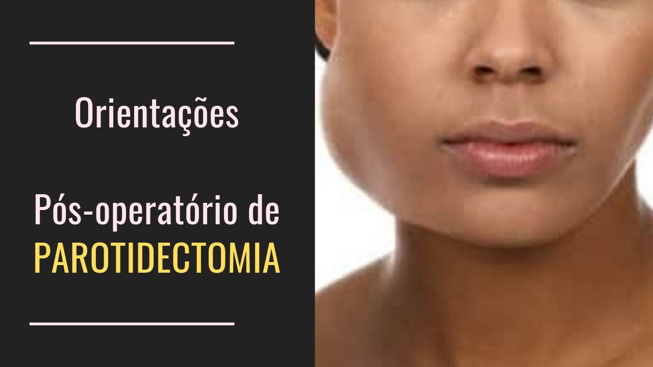 Orientações após parotidectomia - [061]- Dr. Rogério Leite