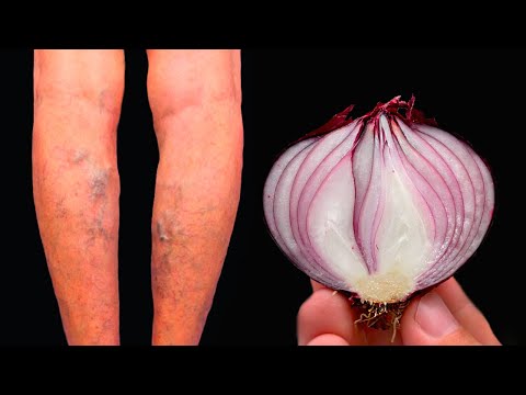 Video: Wat is Grape Dead Arm – Beheer van Grape Dead Arm-symptomen