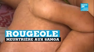 Rougeole meurtrière aux îles Samoa