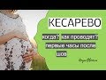 Подготовка к кесарево сечению | что нужно знать