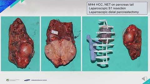 [Symposium 08] HBP 1