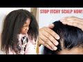 Why Your Scalp IS itchy &amp; How To Treat It!