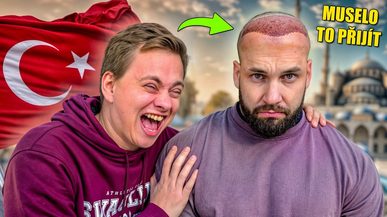 Letím s Nerdem na Transplantaci Vlasů