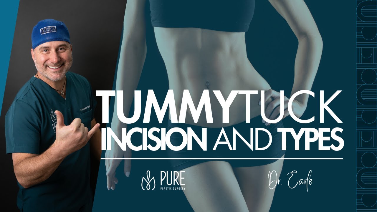 Tummy Tuck Incision and Types – What You Need to Know