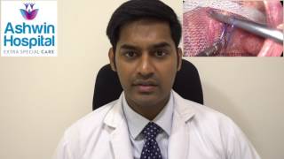 Inguinal Hernia educational video - English