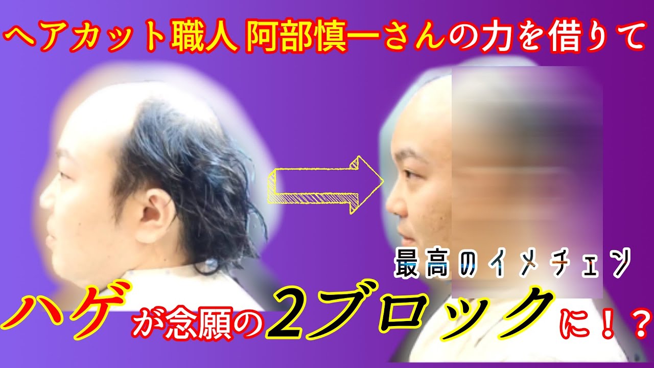 ヘアカット】【ハゲ】落武者ヘアから夢の2ブロックに！プロの力で、最高のイメチェンが出来ました！ ※動画の最後に二人芝居のCM付きです。 -  YouTube