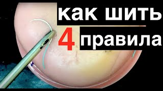 4 правила шитья в лапароскопии //лапароскопический шов //Laparoscopic suturing rules