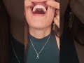 Dental Implants UP CLOSE Teeth Dentalimplants Dental Implants UP CLOSE Teeth Dentalimplants