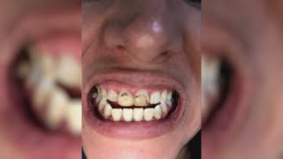 Nurse Returns to Show Off Her Brand-New Smile