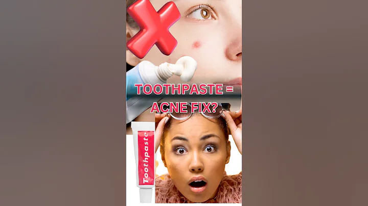 Stop Using Toothpaste on Pimples 😱 Here’s Why? #facefizz #beauty #shorts #skincare #short #skin