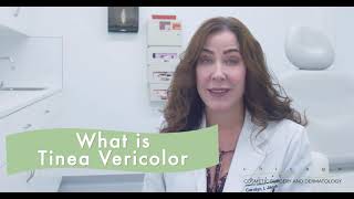 Tinea Versicolor [How to Treat]