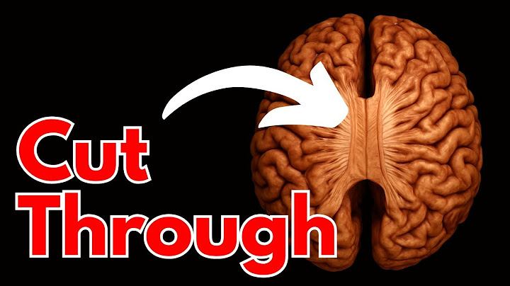 The BIZARRE Truth About Consciousness | What Split Brain Patients Reveal About YOU