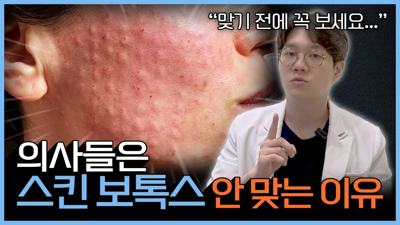 대부분 모르는 스킨보톡스의 치명적인 단점! | '이것'만 알면 스킨보톡스 효과 2배로 볼 수 있습니다