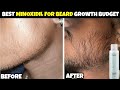 Mars Minoxidil Review | Save Money Grow Beard Fast | mars beard oil review | minoxidil beard