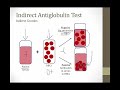 Extrinsic Hemolysis || Boards and Beyond || USMLE step 1