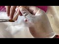 How to do the 3 bead method | acrylic nails tutorial | 3 bead method