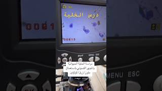 دراسة الخلية بالمجهر الضوئي | باستعمال بطانة الفم | ثانية ثانوي