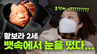 임신 27주차 황보라, 아기가 뱃속에서 눈을 뜬 사건이다  👀ㅣ오덕이엄마 EP.16