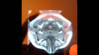 Medical Image Visualization