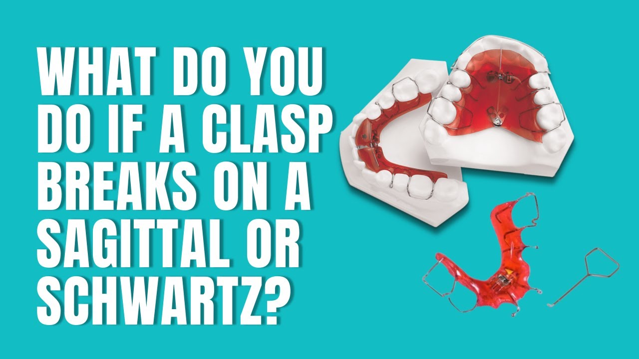 What do you do if a Clasp Breaks on a Sagittal or Schwartz?