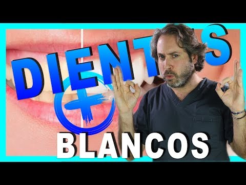 Vídeo: El Mejor Blanqueamiento Dental: Tiras, Pastas Dentales, Pros Y Contras