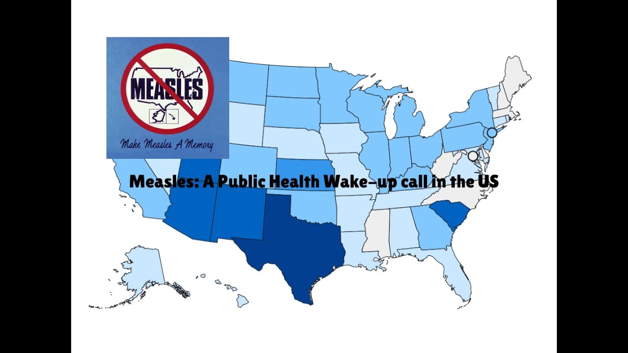 Корь: тревожный сигнал для общественного здравоохранения в США