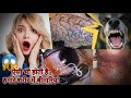 मानव रोग वह प्रभावित अंग बेस्ट ट्रिक वीडियो# human diseases @ crazyguruteach1602 #tricks