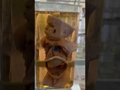 Video: Anatomiska museet. Chockerande utställningar från världens anatomiska museer