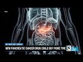 New pancreatic cancer drug could buy more time