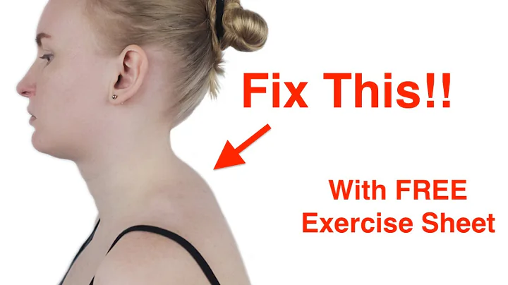 Easy Fix for the Neck Hump! (With FREE Exercise Sheet!)