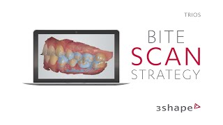 3Shape TRIOS - Scan Strategy - Bite screenshot 5