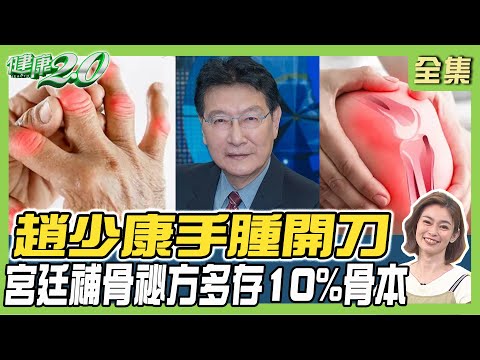 趙少康手腫開刀 1招手指伸肌按摩技活絡手關節! 宮廷補骨祕方多存10%骨本 健康2.0 20240427【完整版】鄭凱云 花世源 莊海華 洪素卿 陳朝龍 雷議宗@tvbshealth20