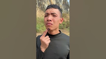 How I Treated Bug Bites with Yogurt in the Wild Survival Tips