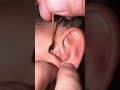 【閲覧注意】《耳掃除》反対の耳からもでっけぇ耳垢はがしてみた #asmr #ear #耳かき #耳垢 #ピンセット #耳掃除 #clean #earwax #wax #귀이개
