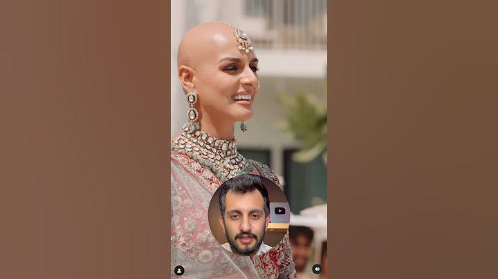 Bald Indian Bride’s Inspiring Story ❤️ #facts #ytshorts #inspiration #motivation