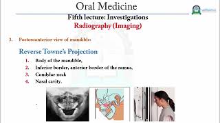 د. محمد الوصابي Fifth lecture  Investigations   Radiography Imaging مقرر طب الفم Oral Medicine
