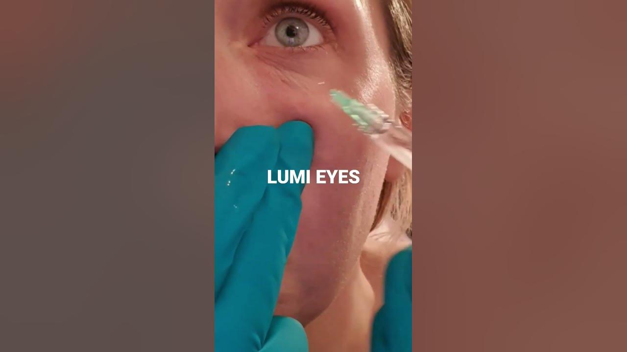 Lumi eyes treatment YouTube